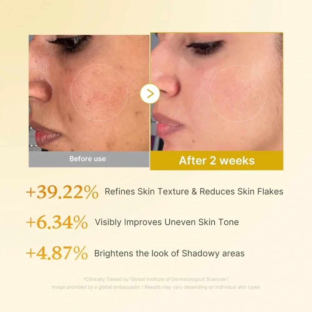 Medicube Kojic Acid Turmeric Resurfacing Toner